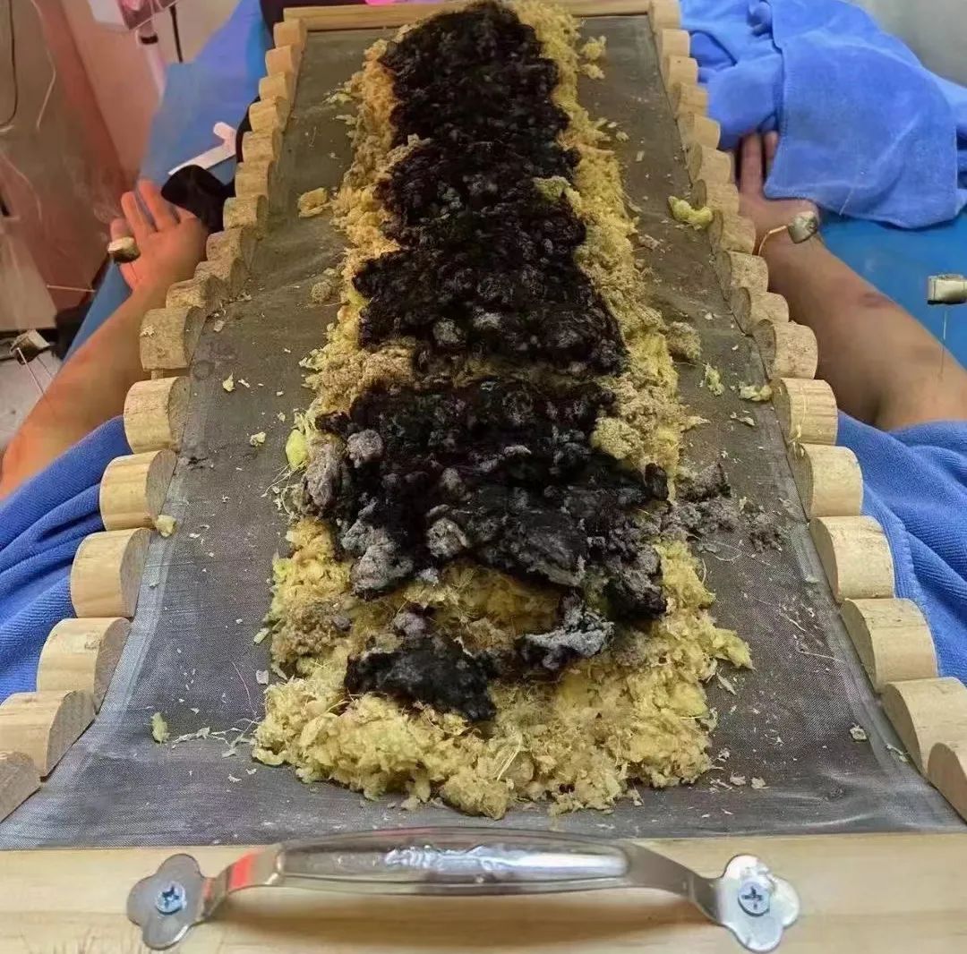龙骨灸.jpg